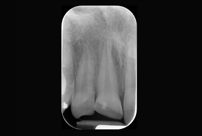 xray image
